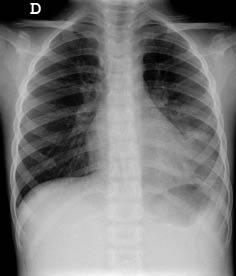 Regreso 1 fig.8_opt