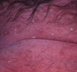 1.Vitoria Fig.2_opt