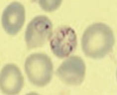 Figura 3. Hematies infectados por Plasmodium.