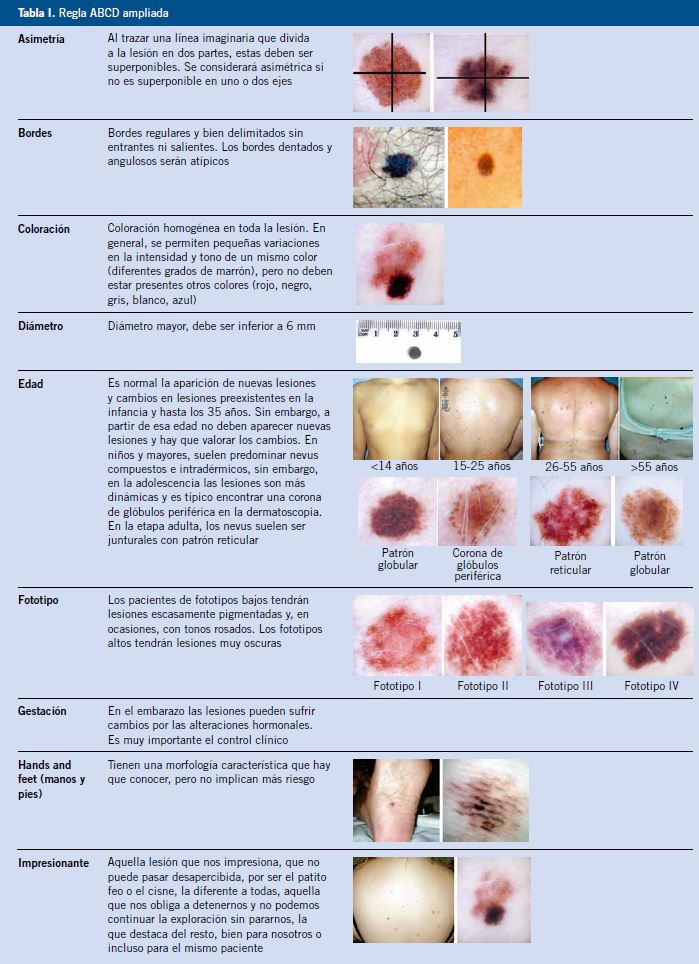 Intertrigo - Trastornos dermatológicos - Manual MSD versión para