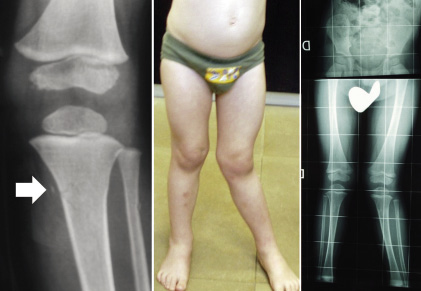 Traumatología y ortopedia - Pediatría integral