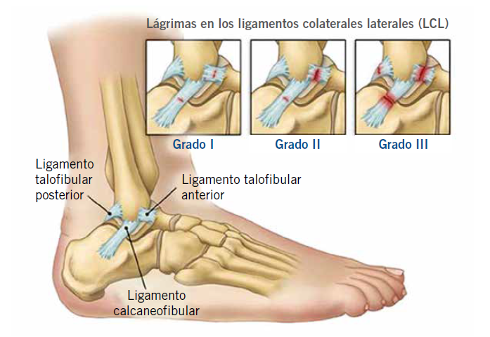 Media de compresión bajo rodilla 15-20 mmHg (hombre) - SL Ortopedia