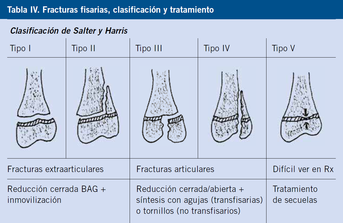 Bibliografía Materialismo Regulación Fracturas infantiles más frecuentes. Esguinces y epifisiolisis | Pediatría  integral