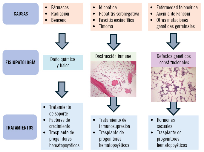 figura